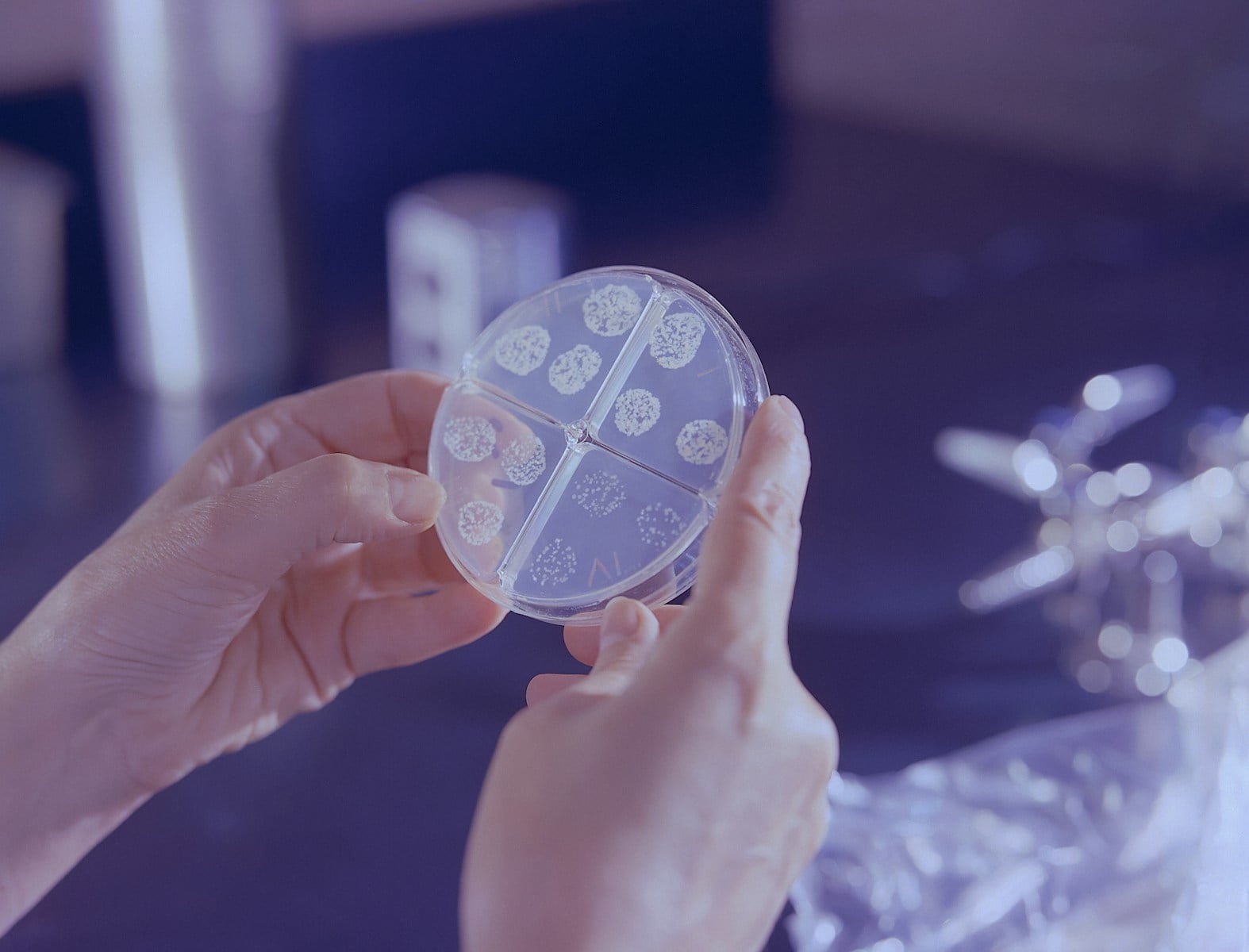 TB Revolutionary Diagnostics