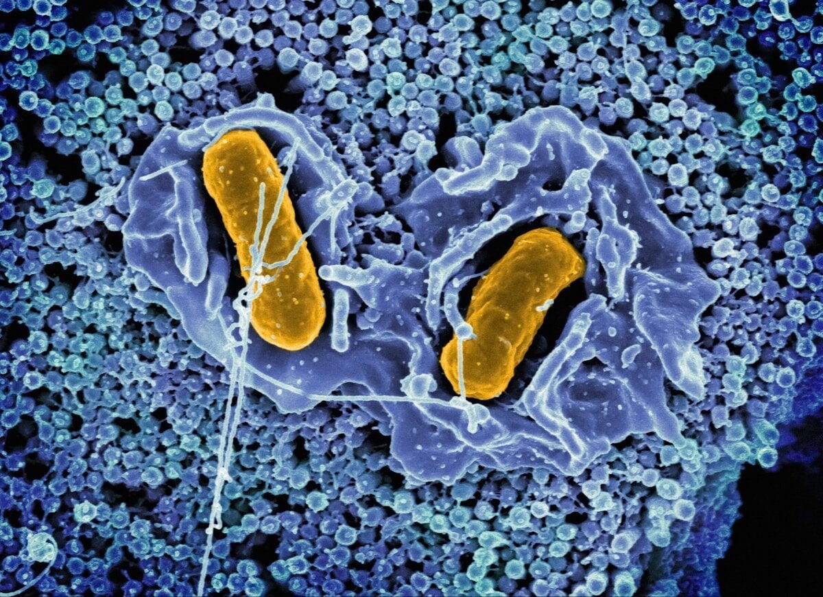 a cell with two yellow cells inside of it